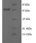 SDS-PAGE separation of QP6080 followed by commassie total protein stain results in a primary band consistent with reported data for GGCT. These data demonstrate Greater than 90% as determined by SDS-PAGE.