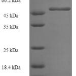 SDS-PAGE separation of QP6082 followed by commassie total protein stain results in a primary band consistent with reported data for GGPS1 / GGPPS1. These data demonstrate Greater than 80.8% as determined by SDS-PAGE.