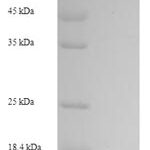 SDS-PAGE separation of QP6085 followed by commassie total protein stain results in a primary band consistent with reported data for Glycerol kinase 2. These data demonstrate Greater than 90% as determined by SDS-PAGE.