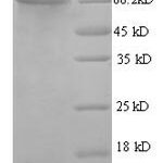 SDS-PAGE separation of QP6087 followed by commassie total protein stain results in a primary band consistent with reported data for D-glucuronyl C5-epimerase. These data demonstrate Greater than 90% as determined by SDS-PAGE.