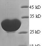 SDS-PAGE separation of QP6089 followed by commassie total protein stain results in a primary band consistent with reported data for GLIPR1 / RTVP1. These data demonstrate Greater than 90% as determined by SDS-PAGE.