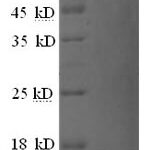 SDS-PAGE separation of QP6090 followed by commassie total protein stain results in a primary band consistent with reported data for GLP-1R / GLP1R. These data demonstrate Greater than 98.9% as determined by SDS-PAGE.