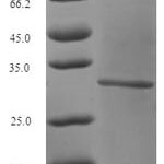 SDS-PAGE separation of QP6096 followed by commassie total protein stain results in a primary band consistent with reported data for Glutaminase kidney isoform