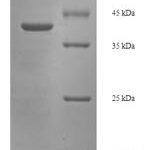 SDS-PAGE separation of QP6098 followed by commassie total protein stain results in a primary band consistent with reported data for Glycolipid transfer protein. These data demonstrate Greater than 90% as determined by SDS-PAGE.