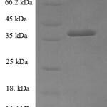 SDS-PAGE separation of QP6104 followed by commassie total protein stain results in a primary band consistent with reported data for Glucosamine-6-phosphate isomerase 1. These data demonstrate Greater than 90% as determined by SDS-PAGE.