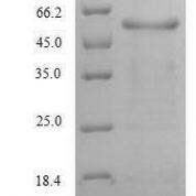 SDS-PAGE separation of QP6114 followed by commassie total protein stain results in a primary band consistent with reported data for Alanine aminotransferase 1. These data demonstrate Greater than 90% as determined by SDS-PAGE.