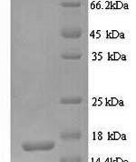 SDS-PAGE separation of QP6120 followed by commassie total protein stain results in a primary band consistent with reported data for Glutamate receptor 3. These data demonstrate Greater than 90% as determined by SDS-PAGE.