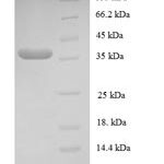 SDS-PAGE separation of QP6131 followed by commassie total protein stain results in a primary band consistent with reported data for GTF2E2. These data demonstrate Greater than 90% as determined by SDS-PAGE.