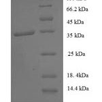 SDS-PAGE separation of QP6133 followed by commassie total protein stain results in a primary band consistent with reported data for General transcription factor IIH subunit 5. These data demonstrate Greater than 90% as determined by SDS-PAGE.