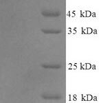 SDS-PAGE separation of QP6134 followed by commassie total protein stain results in a primary band consistent with reported data for Guanylate cyclase activator 2B. These data demonstrate Greater than 90% as determined by SDS-PAGE.