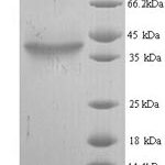 SDS-PAGE separation of QP6144 followed by commassie total protein stain results in a primary band consistent with reported data for Hyaluronan synthase 2. These data demonstrate Greater than 90% as determined by SDS-PAGE.