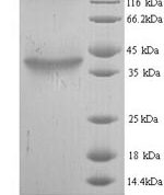 SDS-PAGE separation of QP6144 followed by commassie total protein stain results in a primary band consistent with reported data for Hyaluronan synthase 2. These data demonstrate Greater than 90% as determined by SDS-PAGE.