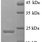 SDS-PAGE separation of QP6145 followed by commassie total protein stain results in a primary band consistent with reported data for TIM3. These data demonstrate Greater than 90% as determined by SDS-PAGE.