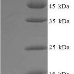 SDS-PAGE separation of QP6150 followed by commassie total protein stain results in a primary band consistent with reported data for Histone deacetylase 1. These data demonstrate Greater than 90% as determined by SDS-PAGE.