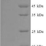 SDS-PAGE separation of QP6155 followed by commassie total protein stain results in a primary band consistent with reported data for HDAC8 / HDACL1. These data demonstrate Greater than 90% as determined by SDS-PAGE.