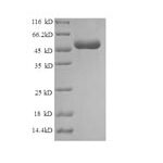 SDS-PAGE separation of QP6157 followed by commassie total protein stain results in a primary band consistent with reported data for Histone H1.1. These data demonstrate Greater than 90% as determined by SDS-PAGE.