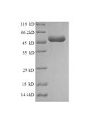 SDS-PAGE separation of QP6157 followed by commassie total protein stain results in a primary band consistent with reported data for Histone H1.1. These data demonstrate Greater than 90% as determined by SDS-PAGE.