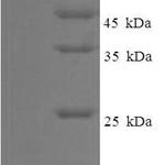 SDS-PAGE separation of QP6162 followed by commassie total protein stain results in a primary band consistent with reported data for Holliday junction recognition protein. These data demonstrate Greater than 90% as determined by SDS-PAGE.