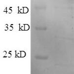 SDS-PAGE separation of QP6163 followed by commassie total protein stain results in a primary band consistent with reported data for Hexokinase-1. These data demonstrate Greater than 90% as determined by SDS-PAGE.