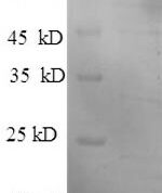 SDS-PAGE separation of QP6163 followed by commassie total protein stain results in a primary band consistent with reported data for Hexokinase-1. These data demonstrate Greater than 90% as determined by SDS-PAGE.