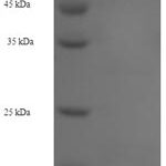 SDS-PAGE separation of QP6165 followed by commassie total protein stain results in a primary band consistent with reported data for Hexokinase-1. These data demonstrate Greater than 90% as determined by SDS-PAGE.