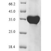 SDS-PAGE separation of QP6167 followed by commassie total protein stain results in a primary band consistent with reported data for HLA-G. These data demonstrate Greater than 90% as determined by SDS-PAGE.