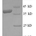 SDS-PAGE separation of QP6169 followed by commassie total protein stain results in a primary band consistent with reported data for HMGCR. These data demonstrate Greater than 90% as determined by SDS-PAGE.