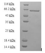 SDS-PAGE separation of QP6175 followed by commassie total protein stain results in a primary band consistent with reported data for Heterogeneous nuclear ribonucleoprotein H. These data demonstrate Greater than 90% as determined by SDS-PAGE.