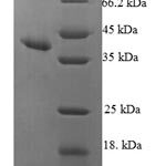 SDS-PAGE separation of QP6182 followed by commassie total protein stain results in a primary band consistent with reported data for Ribonuclease UK114. These data demonstrate Greater than 90% as determined by SDS-PAGE.