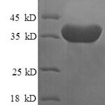 SDS-PAGE separation of QP6188 followed by commassie total protein stain results in a primary band consistent with reported data for Islet cell autoantigen 1. These data demonstrate Greater than 90% as determined by SDS-PAGE.