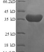 SDS-PAGE separation of QP6188 followed by commassie total protein stain results in a primary band consistent with reported data for Islet cell autoantigen 1. These data demonstrate Greater than 90% as determined by SDS-PAGE.