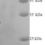 SDS-PAGE separation of QP6196 followed by commassie total protein stain results in a primary band consistent with reported data for IDO2. These data demonstrate Greater than 90% as determined by SDS-PAGE.