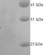 SDS-PAGE separation of QP6196 followed by commassie total protein stain results in a primary band consistent with reported data for IDO2. These data demonstrate Greater than 90% as determined by SDS-PAGE.