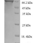 SDS-PAGE separation of QP6197 followed by commassie total protein stain results in a primary band consistent with reported data for Alpha-L-iduronidase. These data demonstrate Greater than 90% as determined by SDS-PAGE.