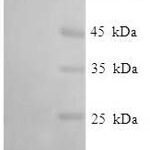 SDS-PAGE separation of QP6198 followed by commassie total protein stain results in a primary band consistent with reported data for IFIT3. These data demonstrate Greater than 90% as determined by SDS-PAGE.