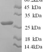 SDS-PAGE separation of QP6210 followed by commassie total protein stain results in a primary band consistent with reported data for IL12B / P40. These data demonstrate Greater than 90% as determined by SDS-PAGE.