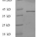 SDS-PAGE separation of QP6211 followed by commassie total protein stain results in a primary band consistent with reported data for IL17 / IL17A. These data demonstrate Greater than 90% as determined by SDS-PAGE.