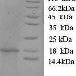 SDS-PAGE separation of QP6215 followed by commassie total protein stain results in a primary band consistent with reported data for IL-1 beta / IL1B. These data demonstrate Greater than 90% as determined by SDS-PAGE.