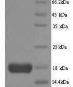 SDS-PAGE separation of QP6216 followed by commassie total protein stain results in a primary band consistent with reported data for IL2 / Interleukin-2. These data demonstrate Greater than 90% as determined by SDS-PAGE.