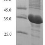 SDS-PAGE separation of QP6217 followed by commassie total protein stain results in a primary band consistent with reported data for IL2 / Interleukin-2. These data demonstrate Greater than 82.1% as determined by SDS-PAGE.