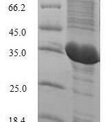 SDS-PAGE separation of QP6217 followed by commassie total protein stain results in a primary band consistent with reported data for IL2 / Interleukin-2. These data demonstrate Greater than 82.1% as determined by SDS-PAGE.