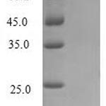 SDS-PAGE separation of QP6218 followed by commassie total protein stain results in a primary band consistent with reported data for IL2 / Interleukin-2. These data demonstrate Greater than 90% as determined by SDS-PAGE.