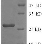 SDS-PAGE separation of QP6219 followed by commassie total protein stain results in a primary band consistent with reported data for CD122 / IL-2RB. These data demonstrate Greater than 90% as determined by SDS-PAGE.