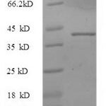 SDS-PAGE separation of QP6221 followed by commassie total protein stain results in a primary band consistent with reported data for IL33 / Interleukin-33 / NF-HEV Protein. These data demonstrate Greater than 90% as determined by SDS-PAGE.