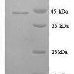 SDS-PAGE separation of QP6225 followed by commassie total protein stain results in a primary band consistent with reported data for IL6 / Interleukin-6 Protein. These data demonstrate Greater than 80% as determined by SDS-PAGE.