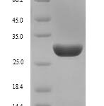 SDS-PAGE separation of QP6226 followed by commassie total protein stain results in a primary band consistent with reported data for IL7R / IL7RA. These data demonstrate Greater than 90% as determined by SDS-PAGE.