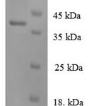 SDS-PAGE separation of QP6227 followed by commassie total protein stain results in a primary band consistent with reported data for IL-8 / CXCL8. These data demonstrate Greater than 90% as determined by SDS-PAGE.