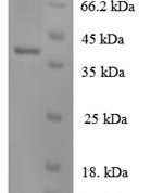 SDS-PAGE separation of QP6227 followed by commassie total protein stain results in a primary band consistent with reported data for IL-8 / CXCL8. These data demonstrate Greater than 90% as determined by SDS-PAGE.