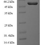 SDS-PAGE separation of QP6230 followed by commassie total protein stain results in a primary band consistent with reported data for ILKAP. These data demonstrate Greater than 90% as determined by SDS-PAGE.