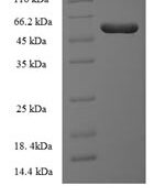 SDS-PAGE separation of QP6230 followed by commassie total protein stain results in a primary band consistent with reported data for ILKAP. These data demonstrate Greater than 90% as determined by SDS-PAGE.